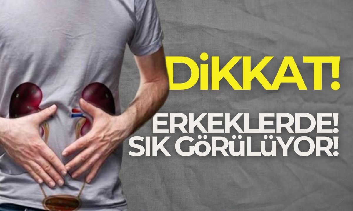 Erkeklerde daha sık görülüyor!
