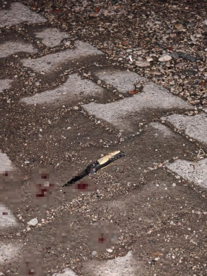 Kız meselesinde kan aktı: 2 bacağından birden bıçaklandı