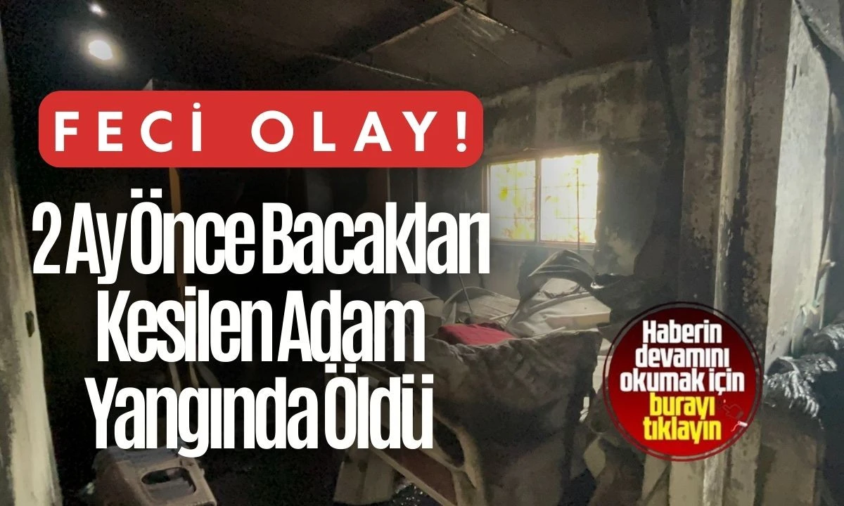 2 Ay Önce Bacakları Kesilen Adam Yangında Öldü