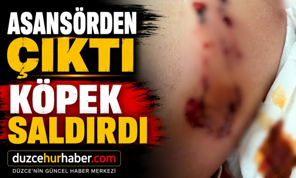 7 Yaşındaki &Ccedil;ocuğa K&ouml;pek Saldırdı! Savunması Tepki &Ccedil;ekti