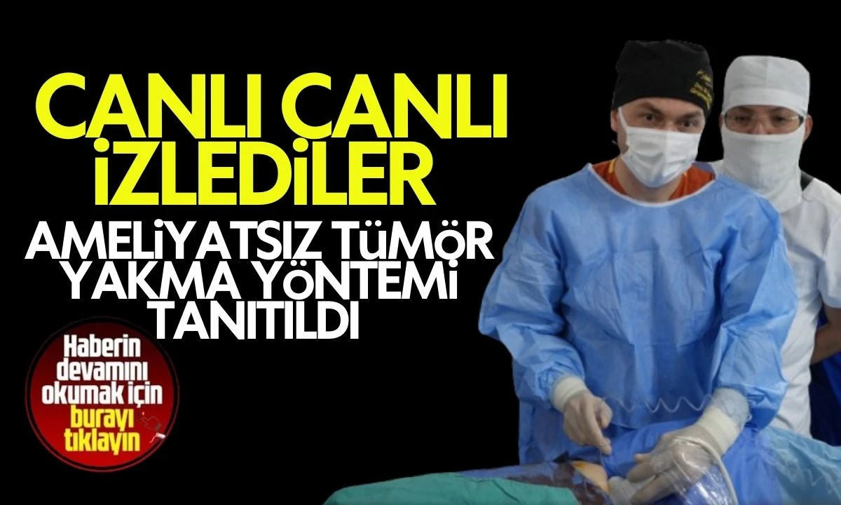 Ameliyatsız Tümör Yakma Yöntemi Tanıtıldı Canlı canlı izlediler 