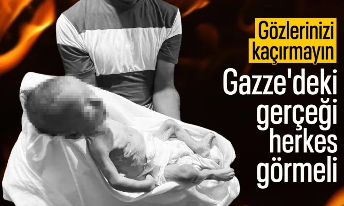 Gazze'de bir bebek daha açlıktan öldü