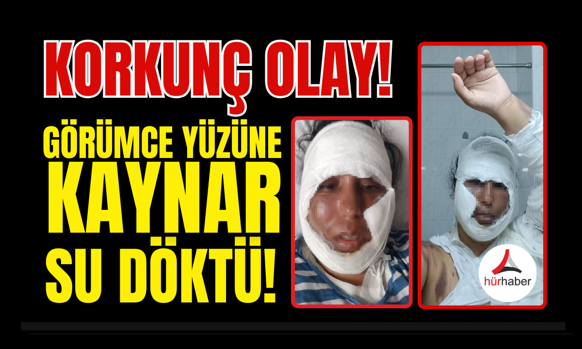Korkun&ccedil; olay G&ouml;r&uuml;mce y&uuml;z&uuml;ne kaynar d&ouml;kt&uuml;!