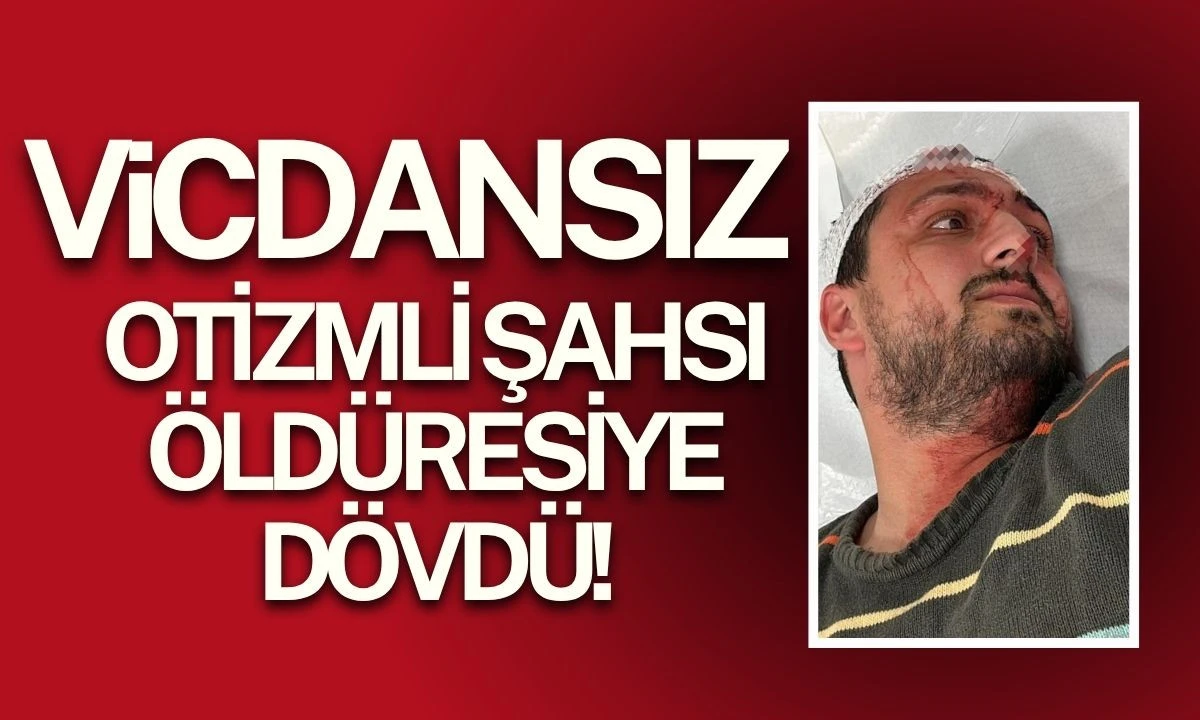 Otizmli şahıs odunla darbedildi Vicdansız 