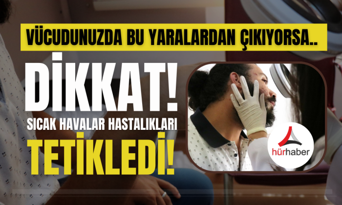 Sıcak havalar cilt hastalıklarını tetikledi! Vatandaş hastanenin yolunu tuttu